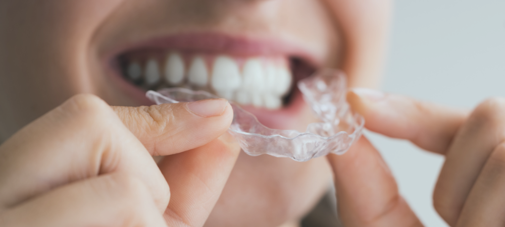 Une gouttière en plastique transparent à poser sur ses dents