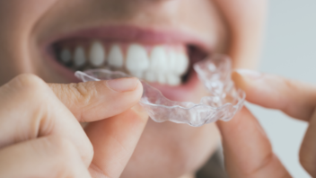 Une gouttière en plastique transparent à poser sur ses dents